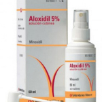 calvície masculina tratada com aloxidil