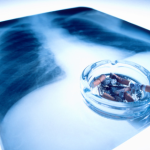 habito de fumar causa males ao corpo